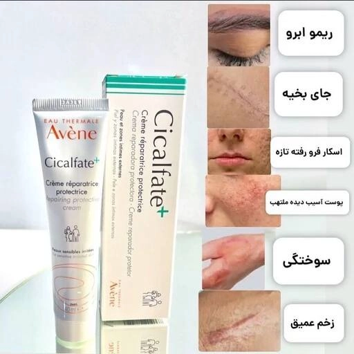 کرم ترمیم کننده سکالفییت پلاس 100 میل ( اورجینال )